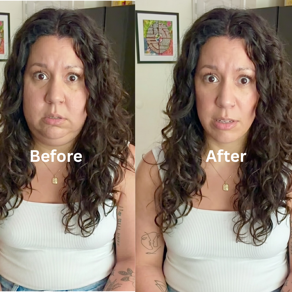 A woman's face before and after — puffiness fading